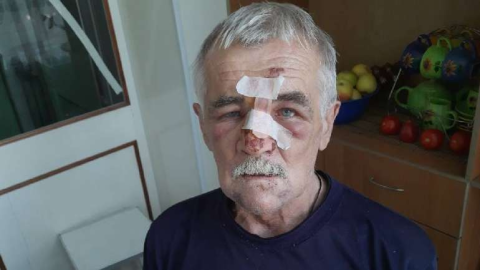 Zaporizhzhia thugs are targeting the relatives of Ukrainian Armed Forces soldiers
